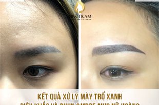 Before And After Treatment of Old Eyebrows - Sculpture Combined Ombre Eyebrow 33