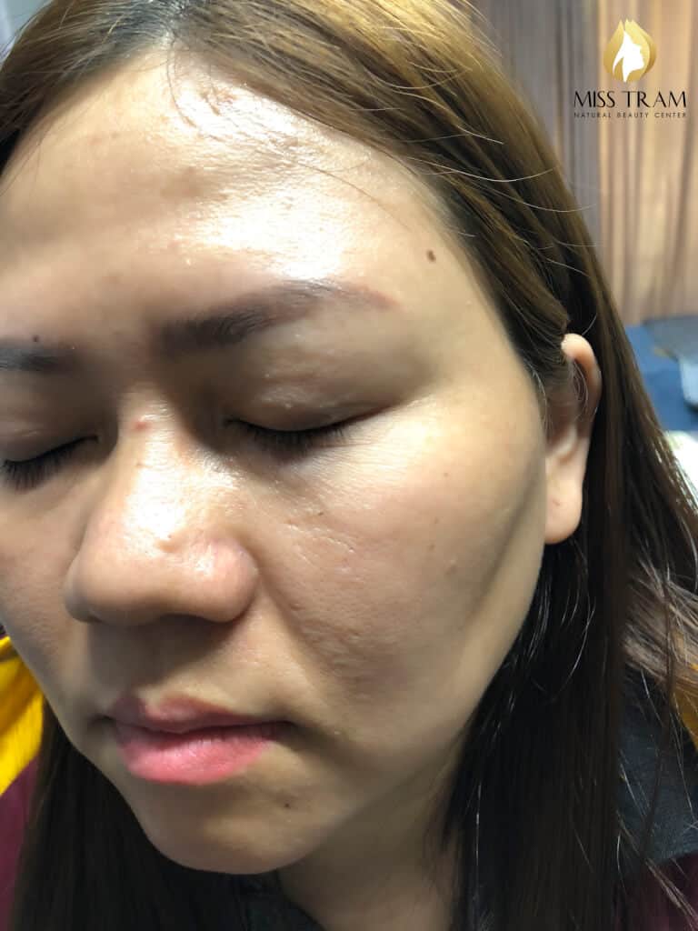 Before And After Treatment of Red Eyebrow - Sculpting and Spraying Ombre 7