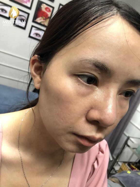 Before And After Sculpting And Mileage of Eyebrows 7