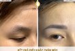 Before And After The Results Of Beautifying Eyebrows With Sculpting Technology 13