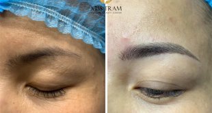 Before And After Sculpting Technology For Beautiful New Eyebrows 1