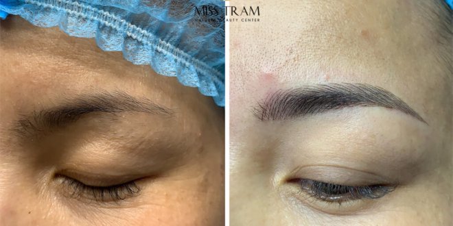 Before And After Sculpting Technology For Beautiful New Eyebrows 5