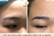 Before And After Treatment - 32 . Natural Fiber Brow Sculpting
