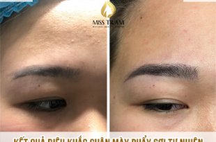 Before And After Treatment - 32 . Natural Fiber Brow Sculpting