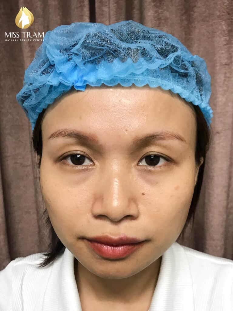Before And After Treating Red Eyebrows - Sculpting Beautiful Queen Eyebrows 7