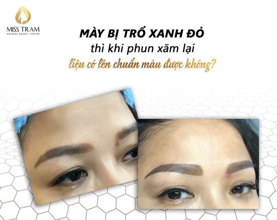 mày bị trổ xanh đỏ