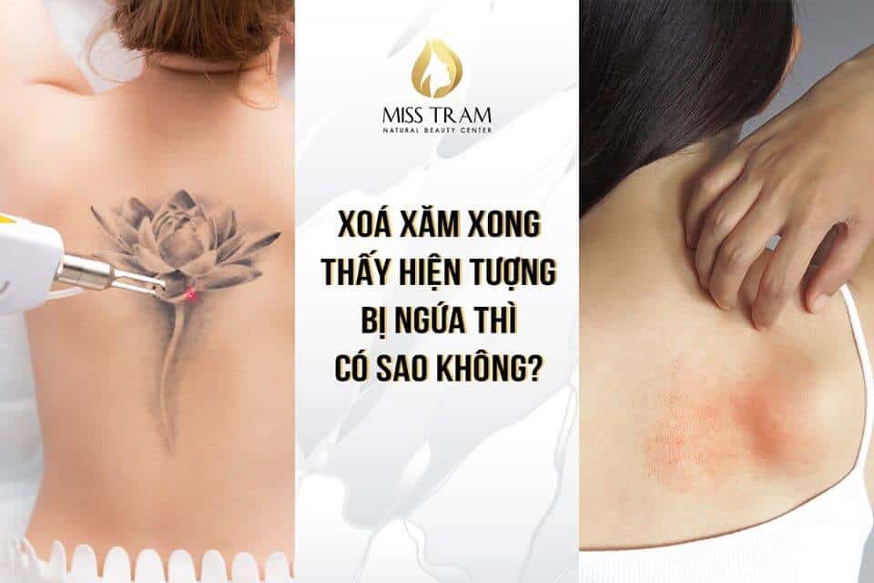 Hình xăm bị bể mực  Nguyên nhân dấu hiệu và cách khắc phục