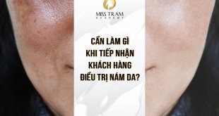What To Do When Receiving Guests With Melasma 3