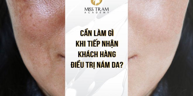 What To Do When Receiving Guests With Melasma 2