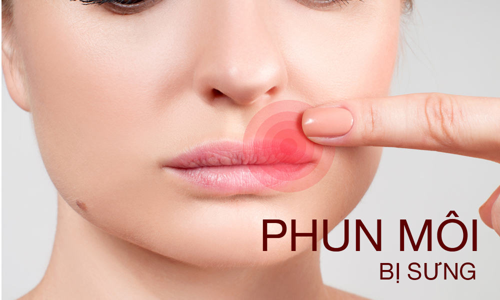 hiện tượng mưng mủ phồng rộp khi phun môi