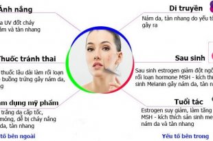 Learn the Stages of Acne 26