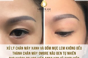 Practitioner Anna Kim Vu locks professional eyebrows on a model Treating blue eyebrows + uneven ink spots into natural dark brown Ombre eyebrows