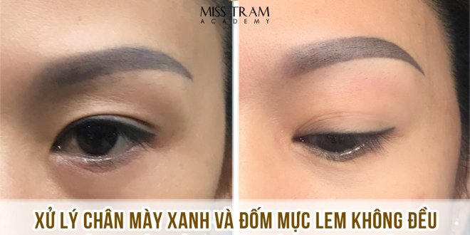 Practitioner Anna Kim Vu locks professional eyebrows on a model Treating blue eyebrows + uneven ink spots into natural dark brown Ombre eyebrows