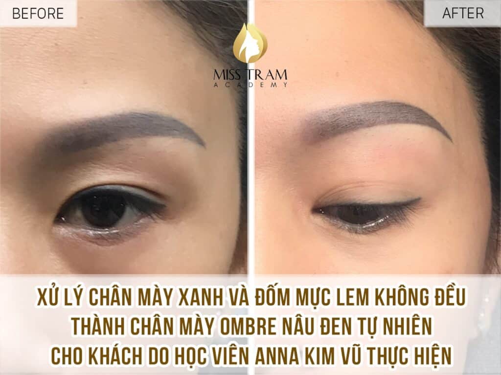 Practitioner Anna Kim Vu locks professional eyebrows on a model Treating blue eyebrows + uneven ink spots into natural dark brown Ombre eyebrows
