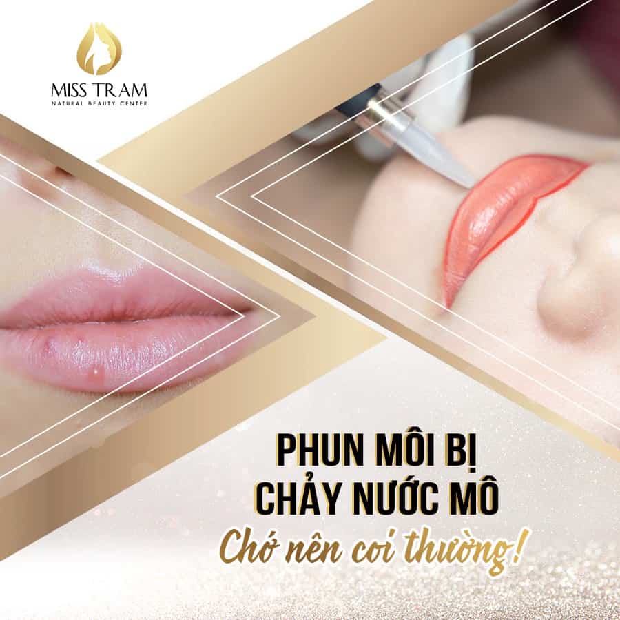 Phun Môi Bị Chảy Nước Mô Chớ Nên Coi Thường