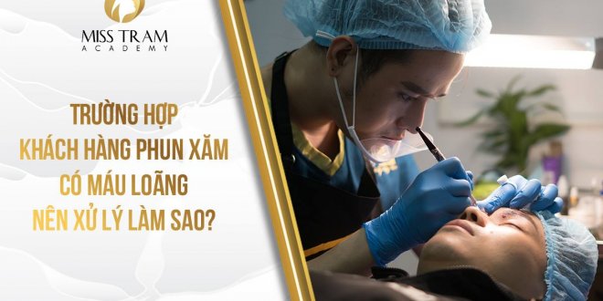 Trường Hợp Khách Hàng Phun Xăm Bị Máu Loãng Phải Làm Sao