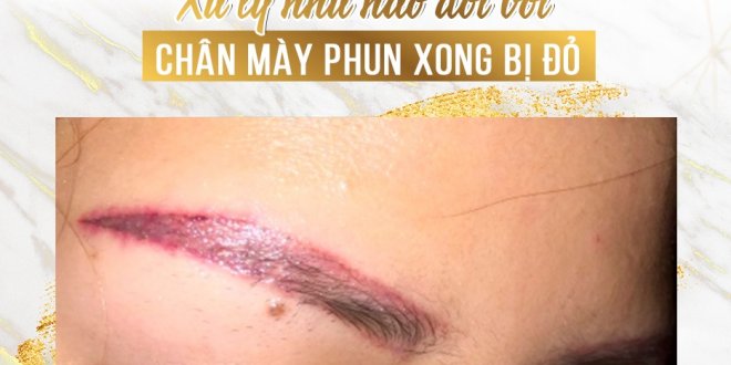 Xử Lý Như Nào Đối Với Chân Mày Phun Xong Bị Đỏ