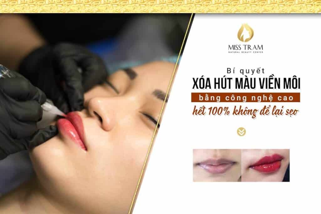 The secret to removing lip color with high technology without leaving scars 3