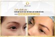 How to Correct Oxidized Eyebrows Blue & Red 80
