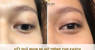 Trainees Perform Eyelid Spray No Swelling Or Pain After Making Sample 21