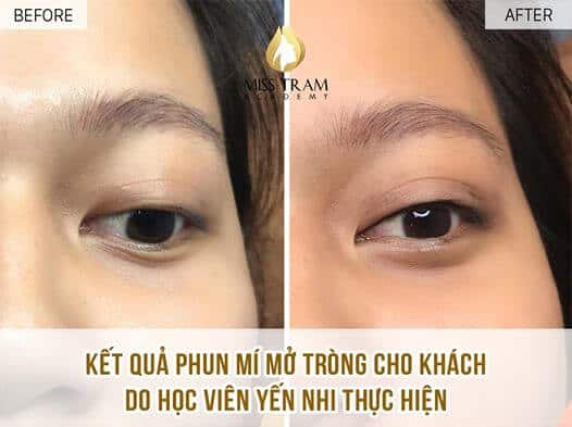 Học Viên Thực Hiện Phun Mí Mở Tròng Không Sưng Hay Đau Sau Khi Làm Cho Mẫu 3