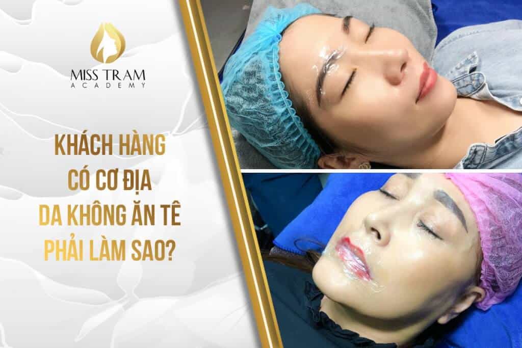 Khách Hàng Có Cơ Địa Da Không Ăn Tê Phải Làm Sao 3