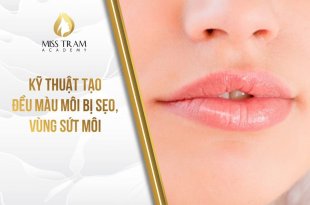 Kỹ Thuật Tạo Đều Màu Môi Bị Sẹo, Vùng Sứt Môi Như Nào 11