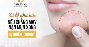 How To Handle If Unfortunately Squeezing Pimples Get Infected 1