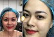 Experience Treating Pale Eyebrows With Sculpture 24