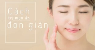 Causes of Hidden Acne & Effective Ways to Treat Acne Hidden Under the Skin 1