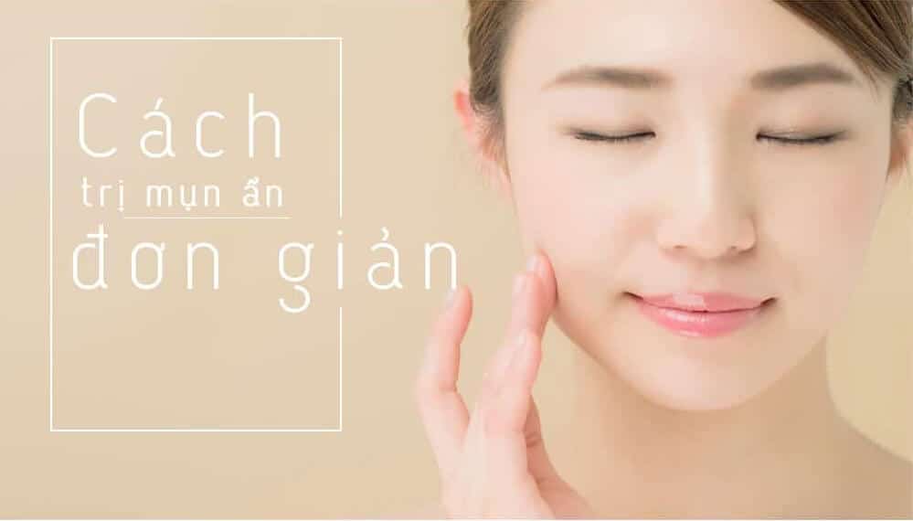 cách trị mụn ẩn dưới da