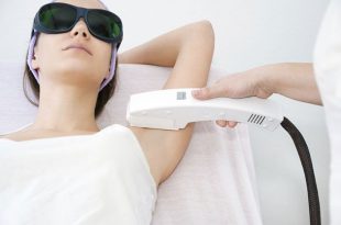 Steps To Remove Armpit Hair With 18 . Diode Laser Technology