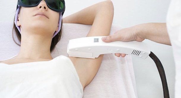 Steps To Remove Armpit Hair With 5 . Diode Laser Technology