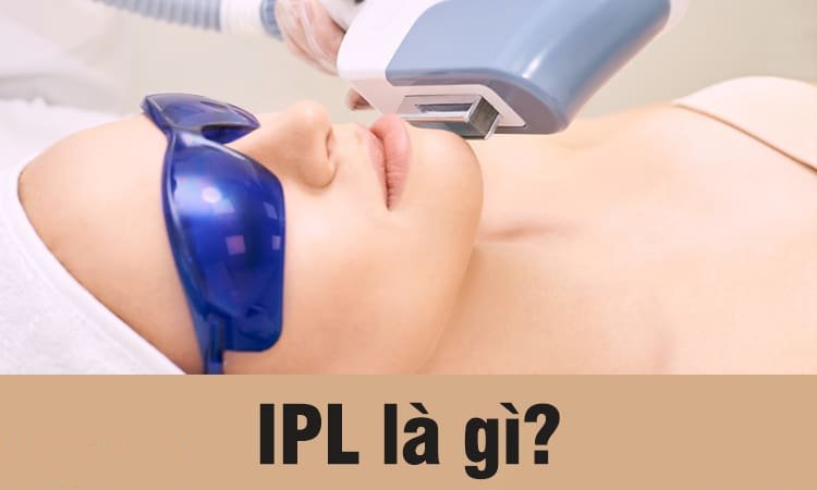 Công nghệ làm đẹp IPL