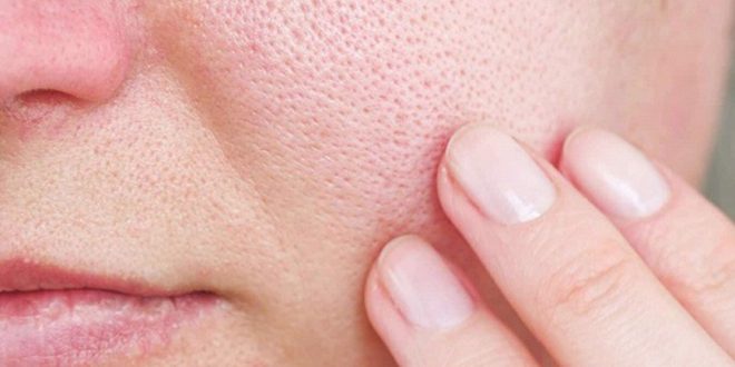 how to fix facial skin with large pores