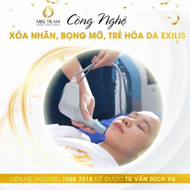 Công Nghệ Exilis