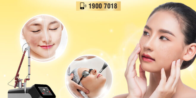 Top 5 Best Laser Technology for Melasma Treatment Today