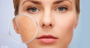 Safe treatment for large pores