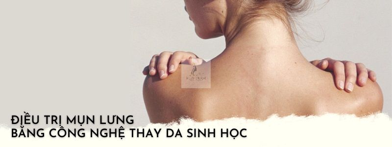 spa trị mụn lưng uy tín hcm