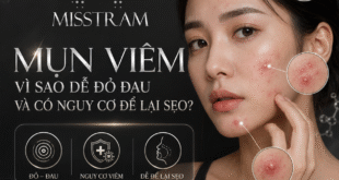Mụn Viêm: Vì Sao Dễ Đỏ Đau Và Có Nguy Cơ Để Lại Sẹo? 4