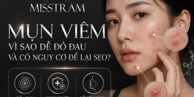 Mụn Viêm: Vì Sao Dễ Đỏ Đau Và Có Nguy Cơ Để Lại Sẹo? 2