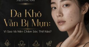 Da Khô Bị Mụn: Vì Sao Và Nên Chăm Sóc Thế Nào? 4