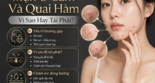 Mụn Ở Cằm Và Quai Hàm: Vì Sao Hay Tái Phát? 4