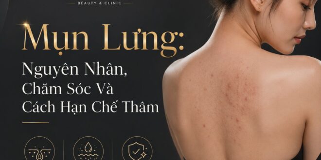 Mụn Lưng: Nguyên Nhân, Chăm Sóc Và Cách Hạn Chế Thâm 2