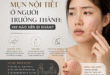 Mụn Nội Tiết Ở Người Trưởng Thành: Khi Nào Nên Đi Khám? 9