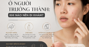 Mụn Nội Tiết Ở Người Trưởng Thành: Khi Nào Nên Đi Khám? 4