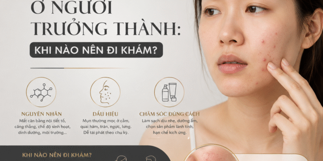 Mụn Nội Tiết Ở Người Trưởng Thành: Khi Nào Nên Đi Khám? 2